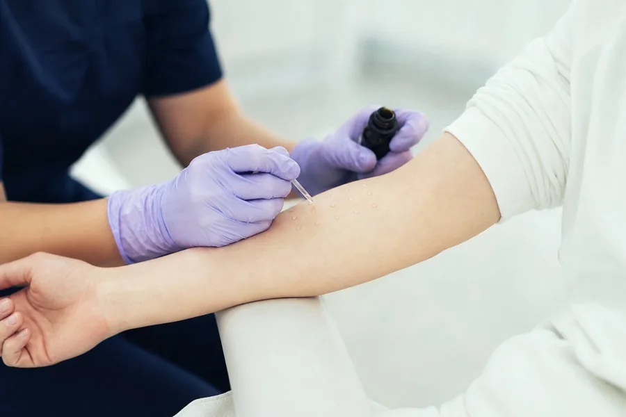 Allergies examination by a consultant
