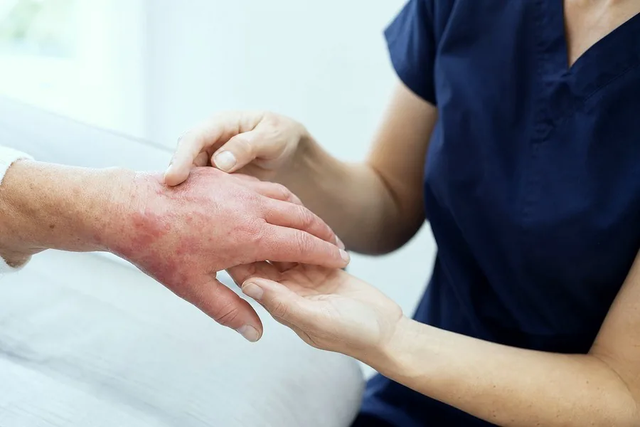 Complex Regional Pain Syndrome (CRPS) examination by a consultant