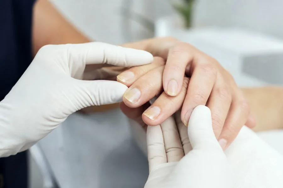 Nail Disorders examination by a consultant