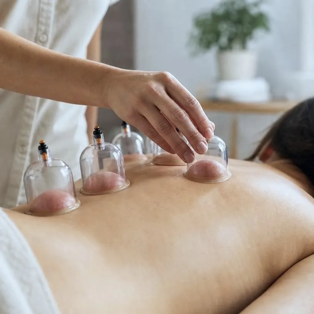 Cupping