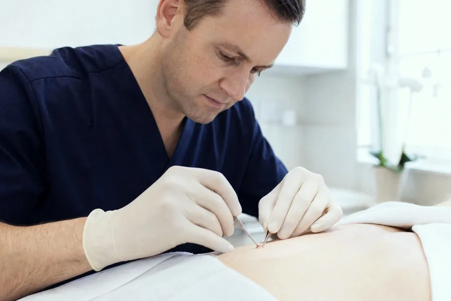 Skin Surgery & Mole Removal